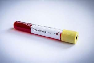 Test coronavirus Sénégal